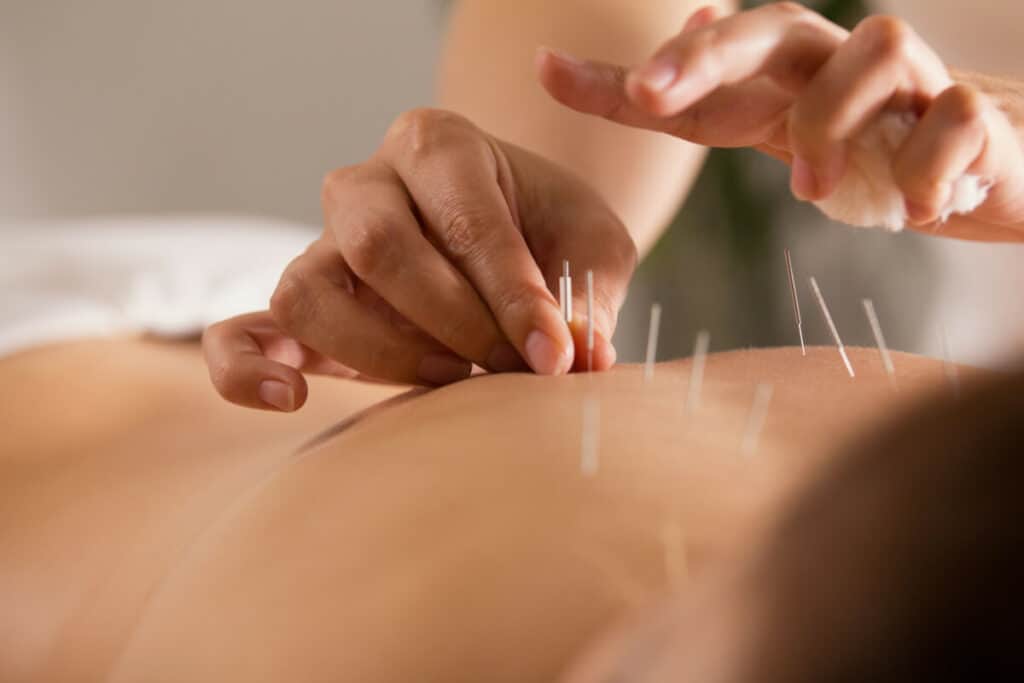 Wellness Fusion: Acupuncture Sessions and All-Natural Magnesium Products Explained